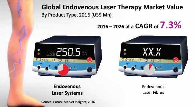 global endovenous laser therapy market