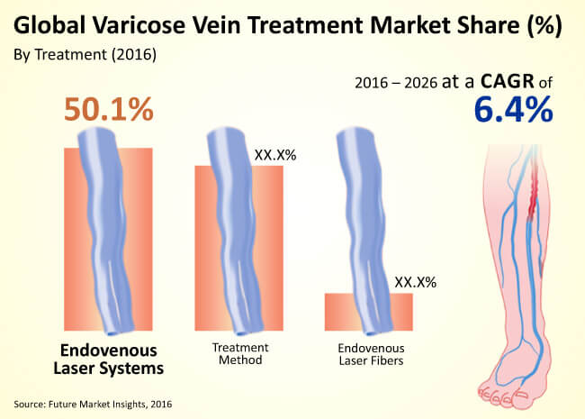 global varicose vein treatment market
