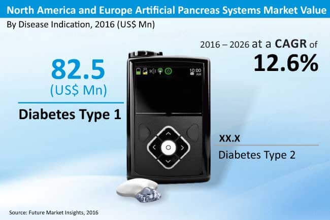 north america and europe artificial pancreas systems market