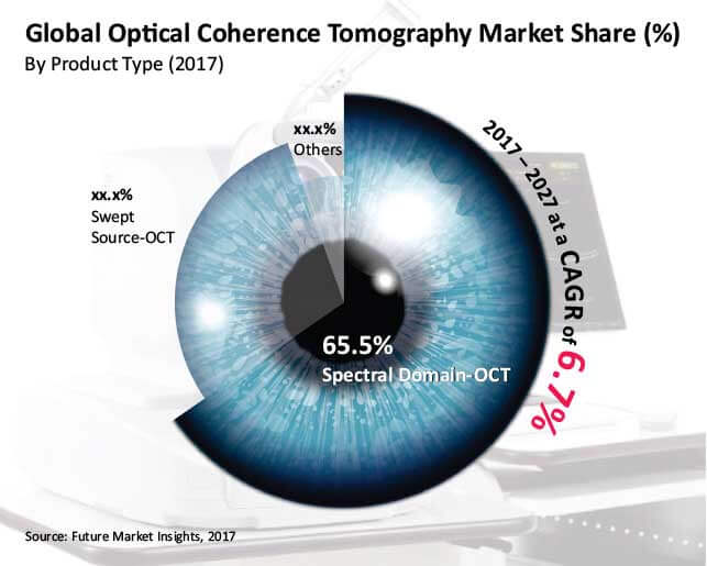 optical coherence tomography market