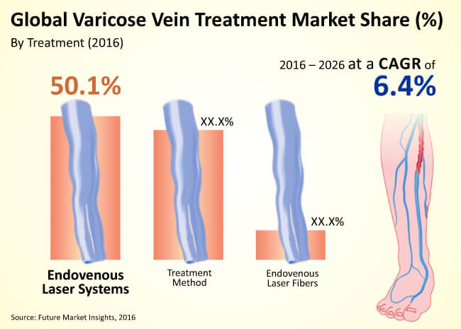 Varicose Vein Size Chart