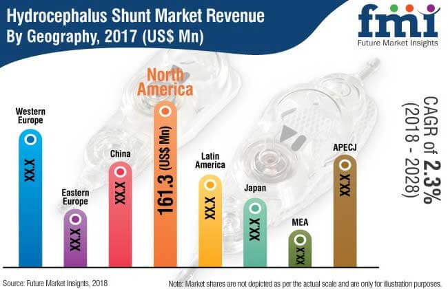 hydrocephalus shunt market