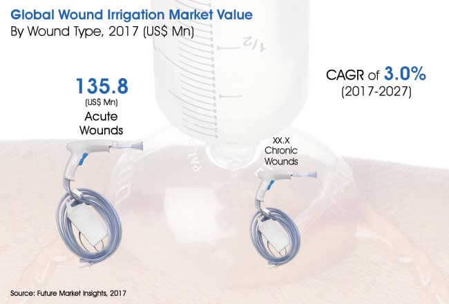 Wound Irrigation Systems Market