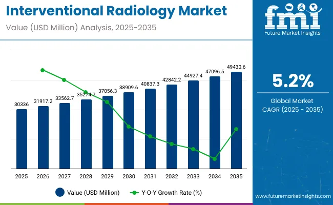 Interventional Radiology Market
