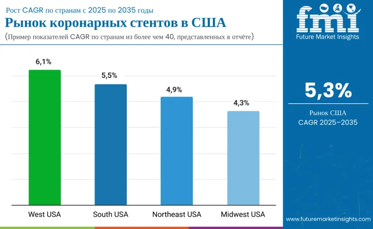 United States Coronary Stents Market By Country Ru