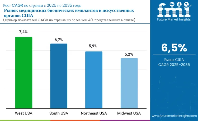 United States Medical Bionic Implant And Artificial Organs Market By Country Ru